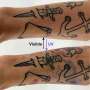 Innovative Chemical Breakthrough Makes Disappearing Tattoos a Reality